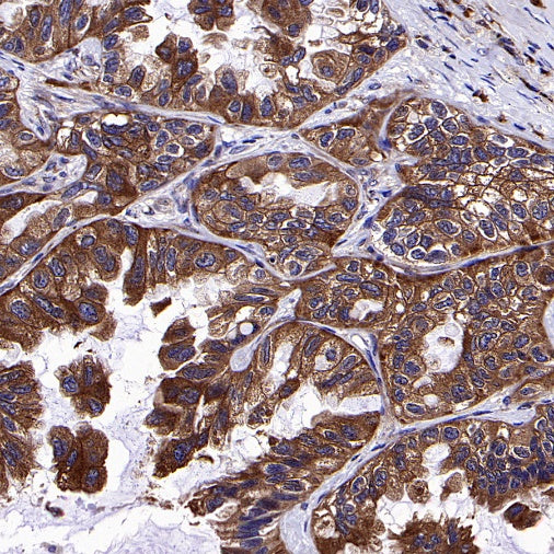 GORASP2 Recombinant Rabbit mAb (S-2526-47)