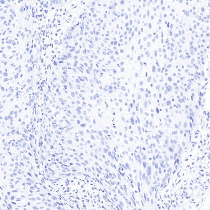 S-RMab® GCDFP-15 Recombinant Rabbit mAb (SDT-R030)