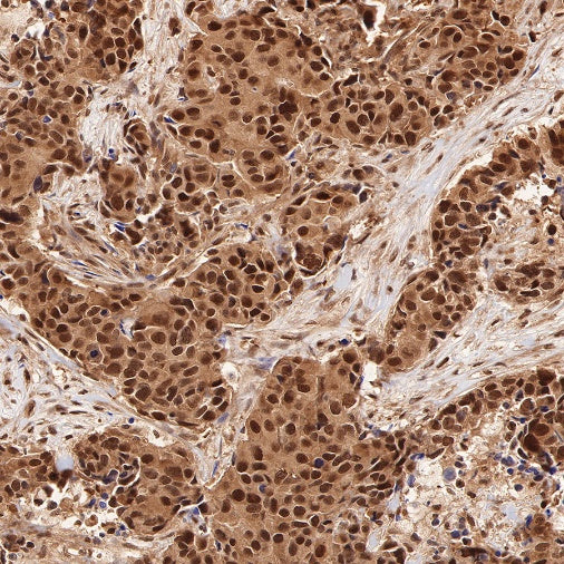 RBX1 Recombinant Rabbit mAb (S-R355)