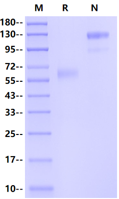 Ephrin-B2 Fc Chimera Protein, Human