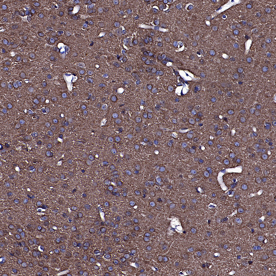 TUBA1A Rabbit Polyclonal Antibody