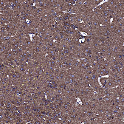 TUBA1A Rabbit Polyclonal Antibody