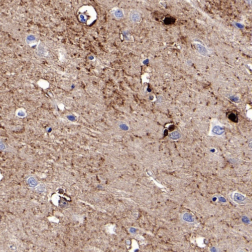 FABP7 Recombinant Rabbit mAb (S-762-41)
