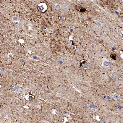 FABP7 Recombinant Rabbit mAb (S-762-41)