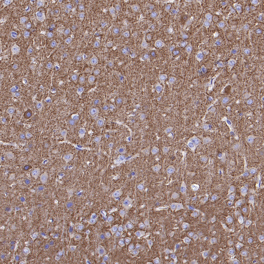 GABRA1 Recombinant Rabbit mAb (S-3254-10)