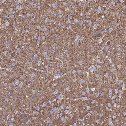 GABRA1 Recombinant Rabbit mAb (S-3254-10)
