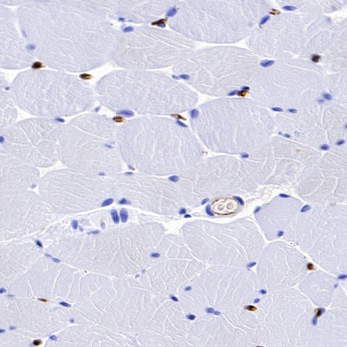 FABP4 Recombinant Rabbit mAb (S-1360-58）
