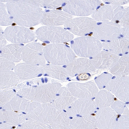FABP4 Recombinant Rabbit mAb (S-1360-58）