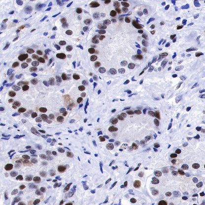 S-RMab® MCM2 Recombinant Rabbit mAb (SDT-018-68)