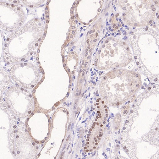 Cleaved Caspase-3 (Asp175) Recombinant Rabbit mAb (S-1406-409)