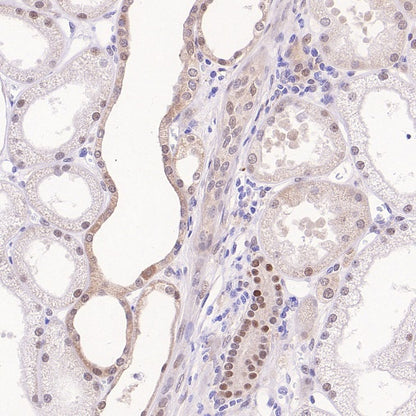 Cleaved Caspase-3 (Asp175) Recombinant Rabbit mAb (S-1406-409)