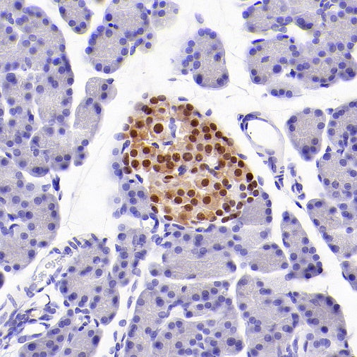 INSM1 Recombinant Rabbit mAb,PBS Only (SDT-3165-72)