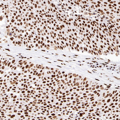 PML Recombinant Rabbit mAb (S-1908-60)