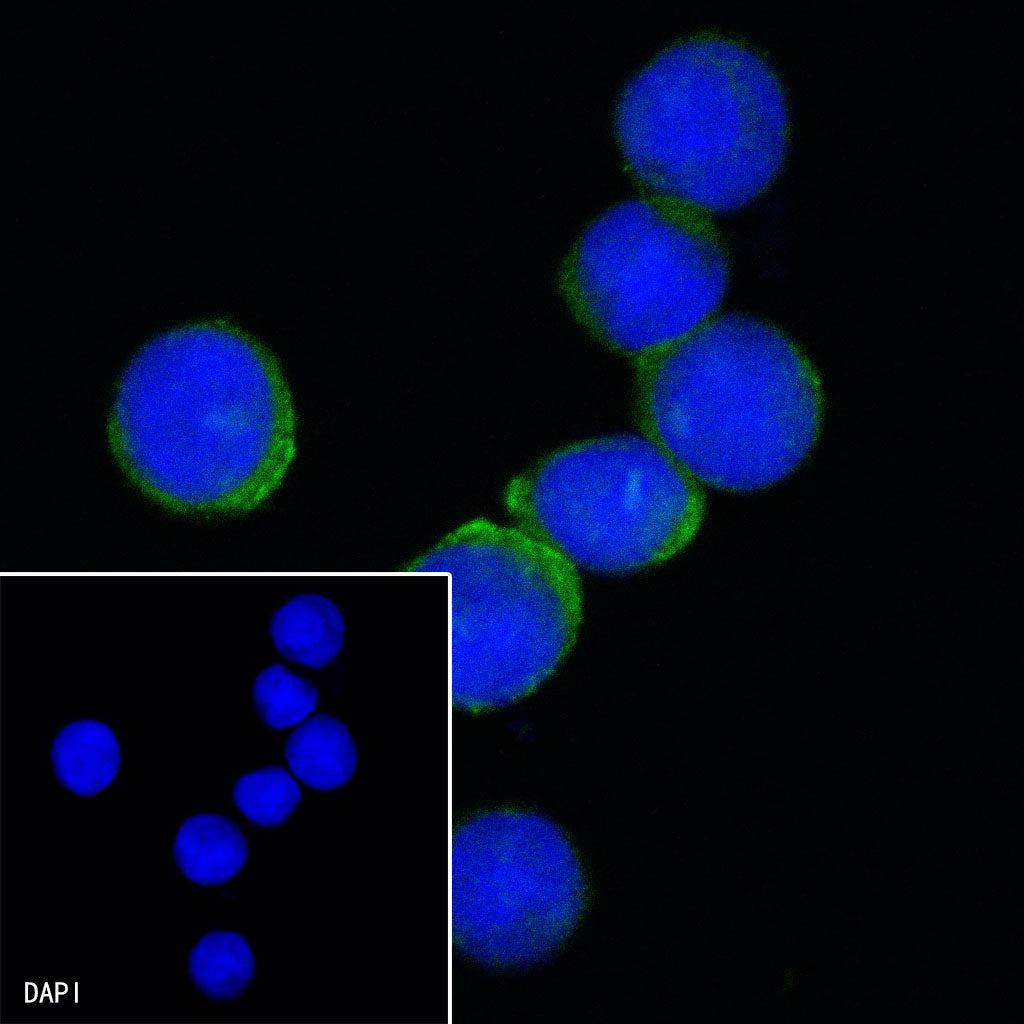 CD36 Recombinant Rabbit mAb,PBS Only (SDT-358-19)