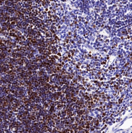 LEF1 Recombinant Rabbit mAb (S-500-34)