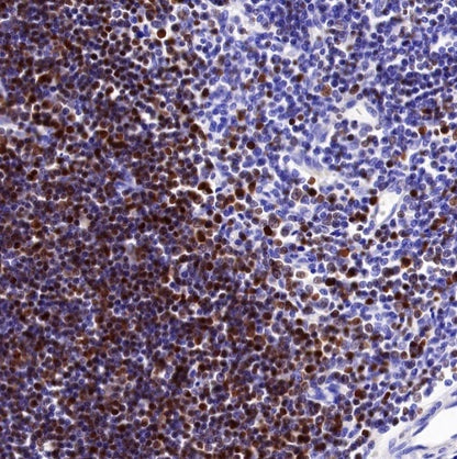 LEF1 Recombinant Rabbit mAb (S-500-34)