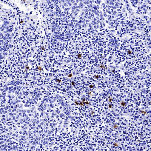 CLEC4C Recombinant Rabbit mAb (S-3825)