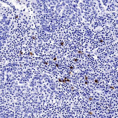 CLEC4C Recombinant Rabbit mAb (S-3825)