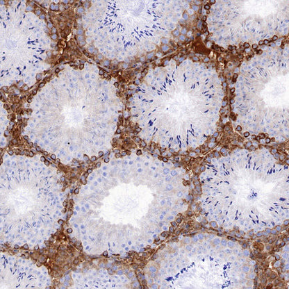 FMRP Recombinant Rabbit mAb (S-1671-1)