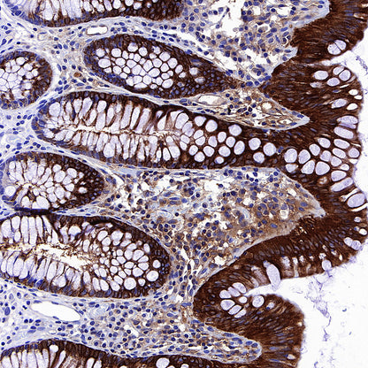 COX2 / Cyclooxygenase Recombinant Rabbit mAb (S-5952)