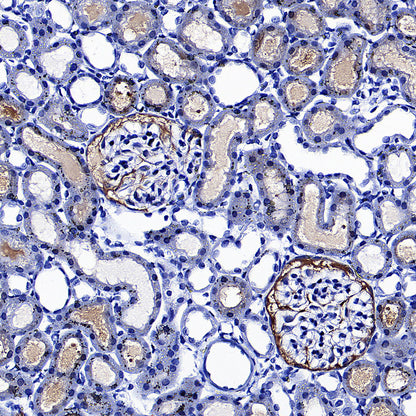 PCK1 Rabbit Polyclonal Antibody
