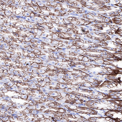 Claudin18.2 Recombinant Rabbit mAb,PBS Only (SDT-102-24)