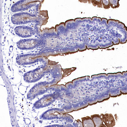 ALPI Recombinant Rabbit mAb (S-3768-104)