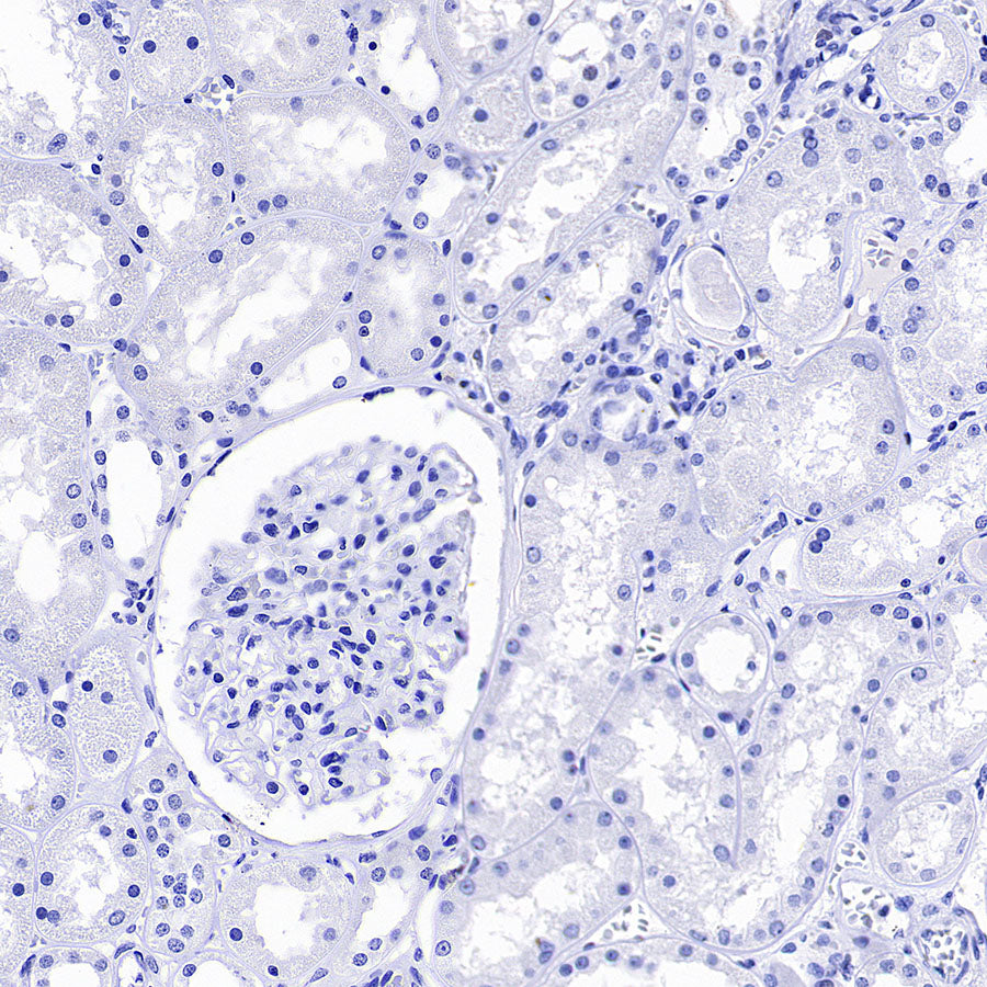 PNPLA2 Recombinant Rabbit mAb (S-5409)
