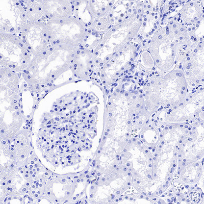 PNPLA2 Recombinant Rabbit mAb (S-5409)