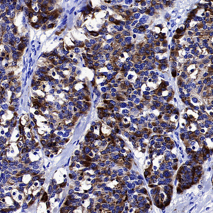 BRN3A Recombinant Rabbit mAb (S-3253-25)