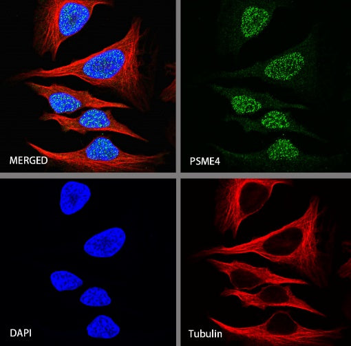 PSME4 Recombinant Rabbit mAb (S-1502-70)