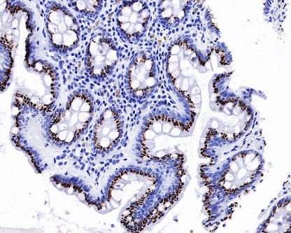 GP73/GOLPH2 Recombinant Rabbit mAb (SDT-231-102)