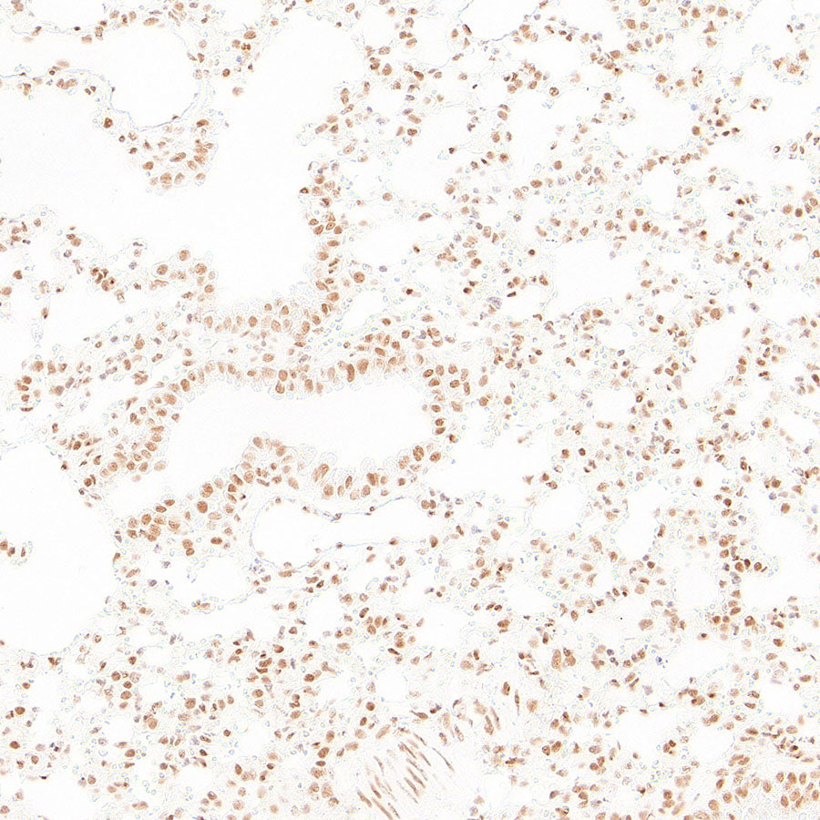 RAD21 Recombinant Rabbit mAb (S-4271-136)