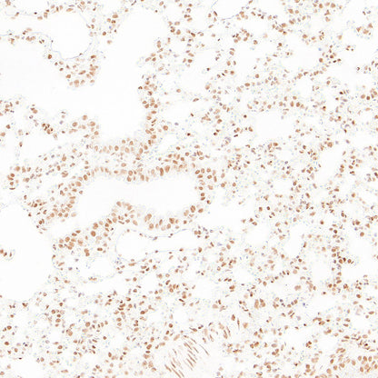RAD21 Recombinant Rabbit mAb (S-4271-136)