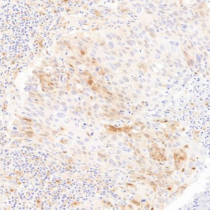 Galectin-9 Recombinant Rabbit mAb (S-4579-67)