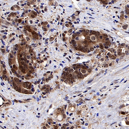Superoxide dismutase Rabbit Polyclonal Antibody