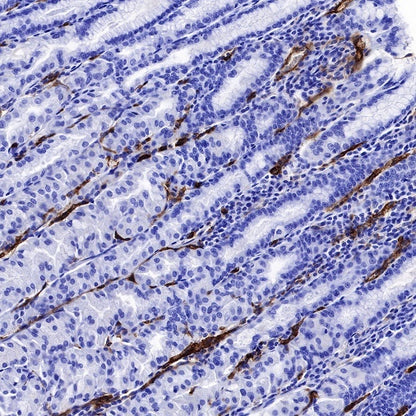CD36 Recombinant Rabbit mAb,PBS Only (SDT-358-19)