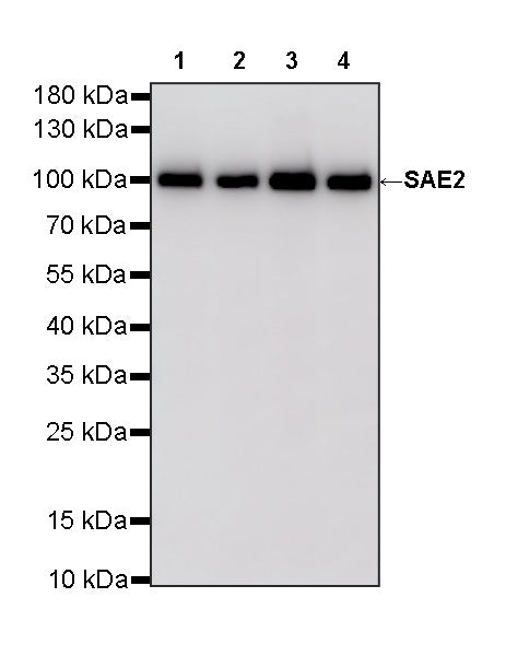 SAE2 Recombinant Rabbit mAb (S-4888-5)