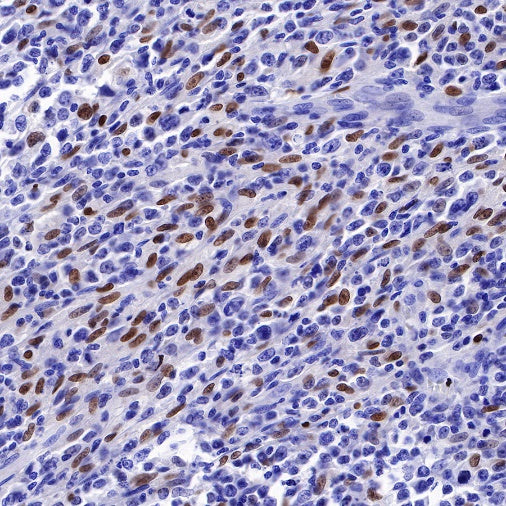 S-RMab® PU.1 Recombinant Rabbit mAb (SDT-R236)