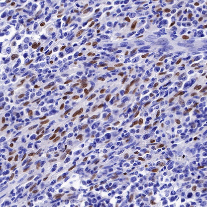 S-RMab® PU.1 Recombinant Rabbit mAb (SDT-R236)