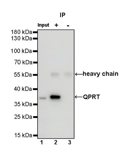 QPRT Recombinant Rabbit mAb (S-1228-31)