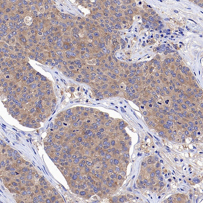 JAK1 Recombinant Rabbit mAb (S-1819-142)