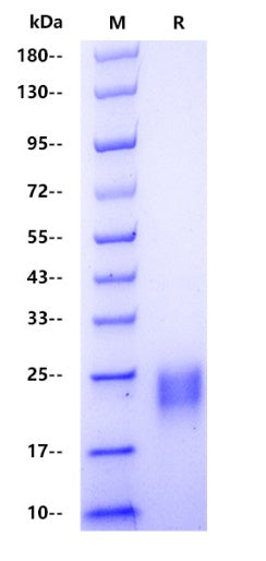 Human TIMP2 Protein, His Tag