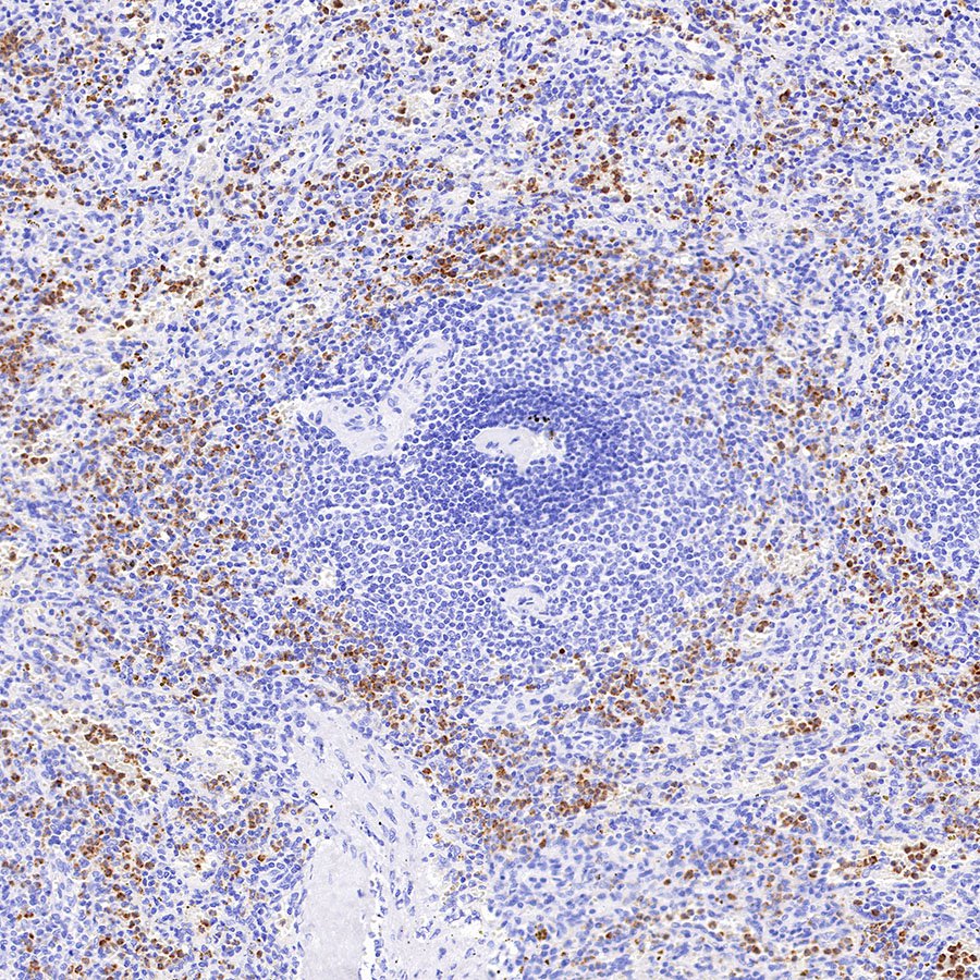 Neutrophil Elastase Recombinant Rabbit mAb (S-R230)