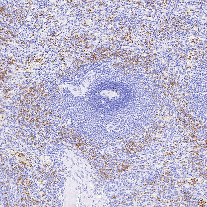 Neutrophil Elastase Recombinant Rabbit mAb (S-R230)