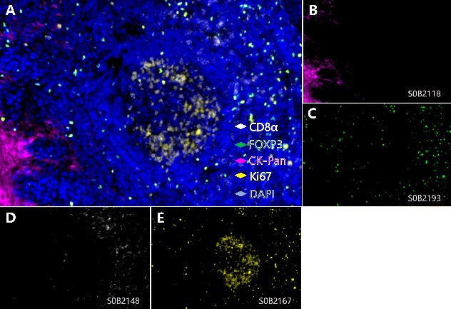 Ki67, FOXP3, CD8α, CK-Pan Antibody Panel