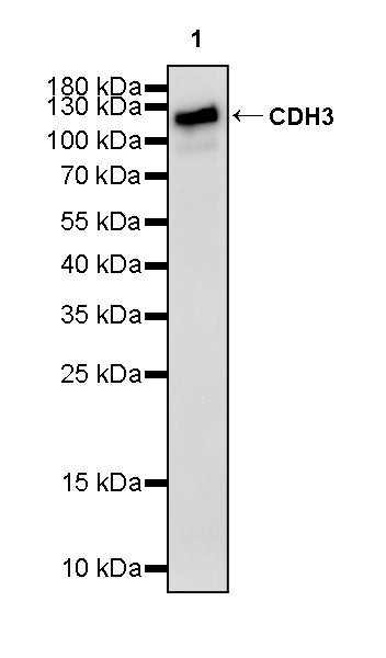 CDH3 Recombinant Rabbit mAb (S-3576-116)