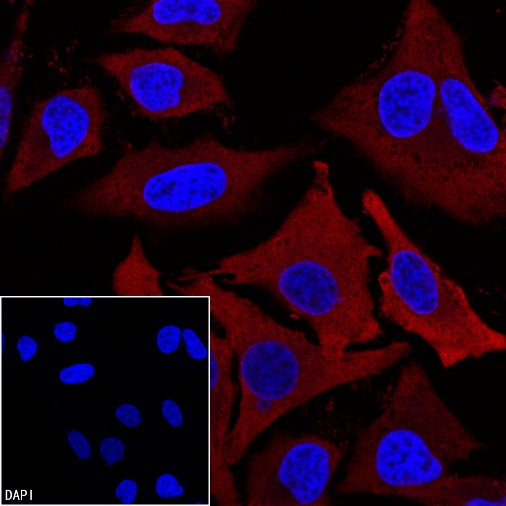FASN Recombinant Rabbit mAb (PE Conjugate) (S-682-32)
