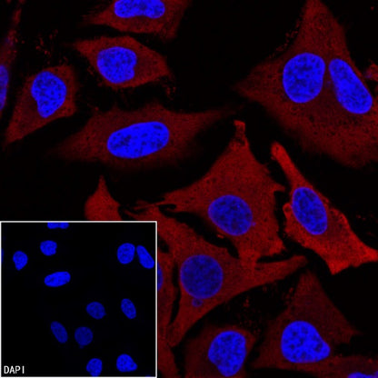 FASN Recombinant Rabbit mAb (PE Conjugate) (S-682-32)