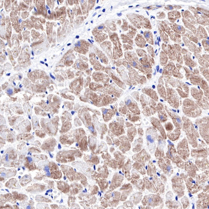 alpha-actinin-2 Recombinant Rabbit mAb (SDT-032-79)